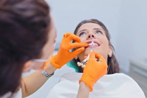 faceta dentária